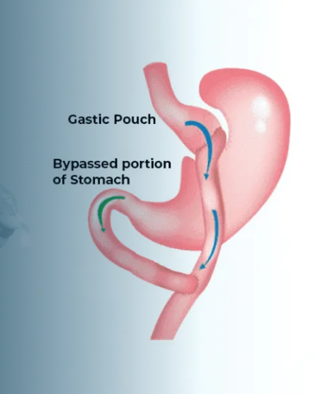 NObesity - Weight Loss Surgery Center photo 4