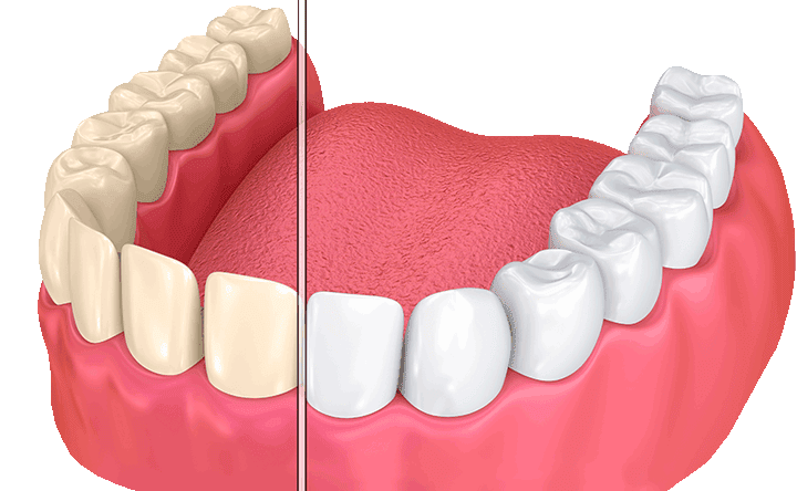 Sunrise Dental of Puyallup