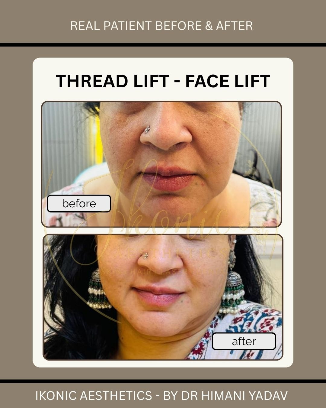 Dr Himani Yadav - Cosmetic Surgeon photo 2