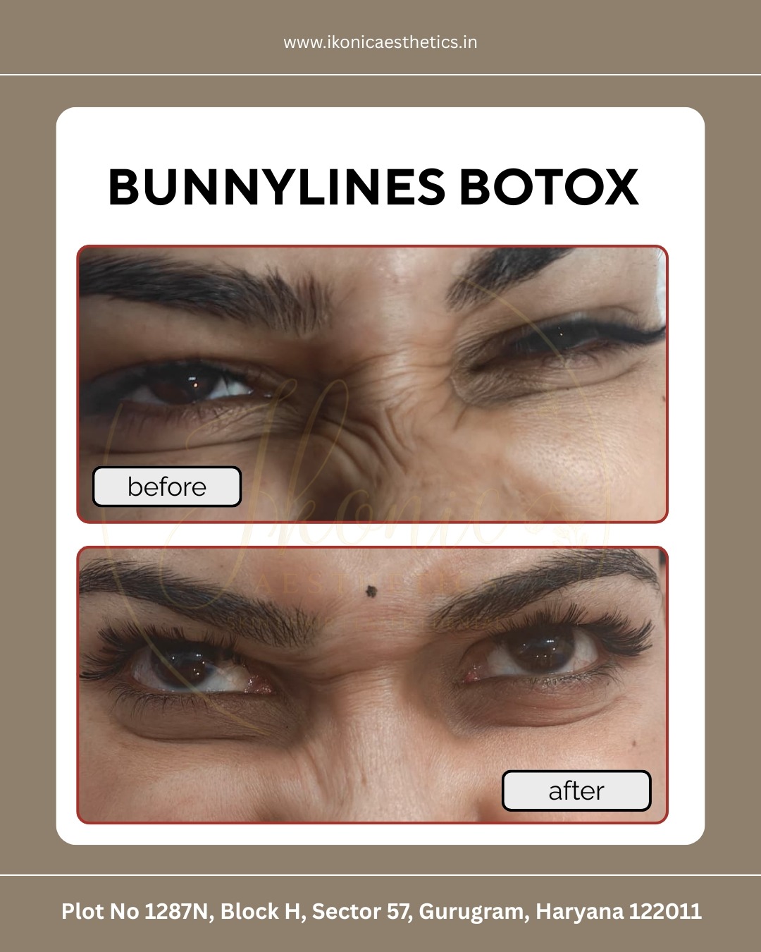 Dr Himani Yadav - Cosmetic Surgeon photo 3