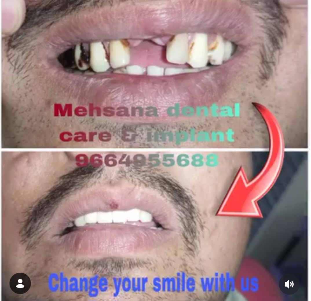 Mehsana dental clinic & implant center photo 15