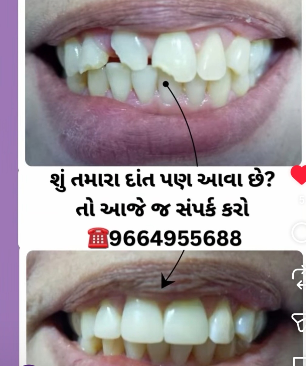 Mehsana dental clinic & implant center photo 21