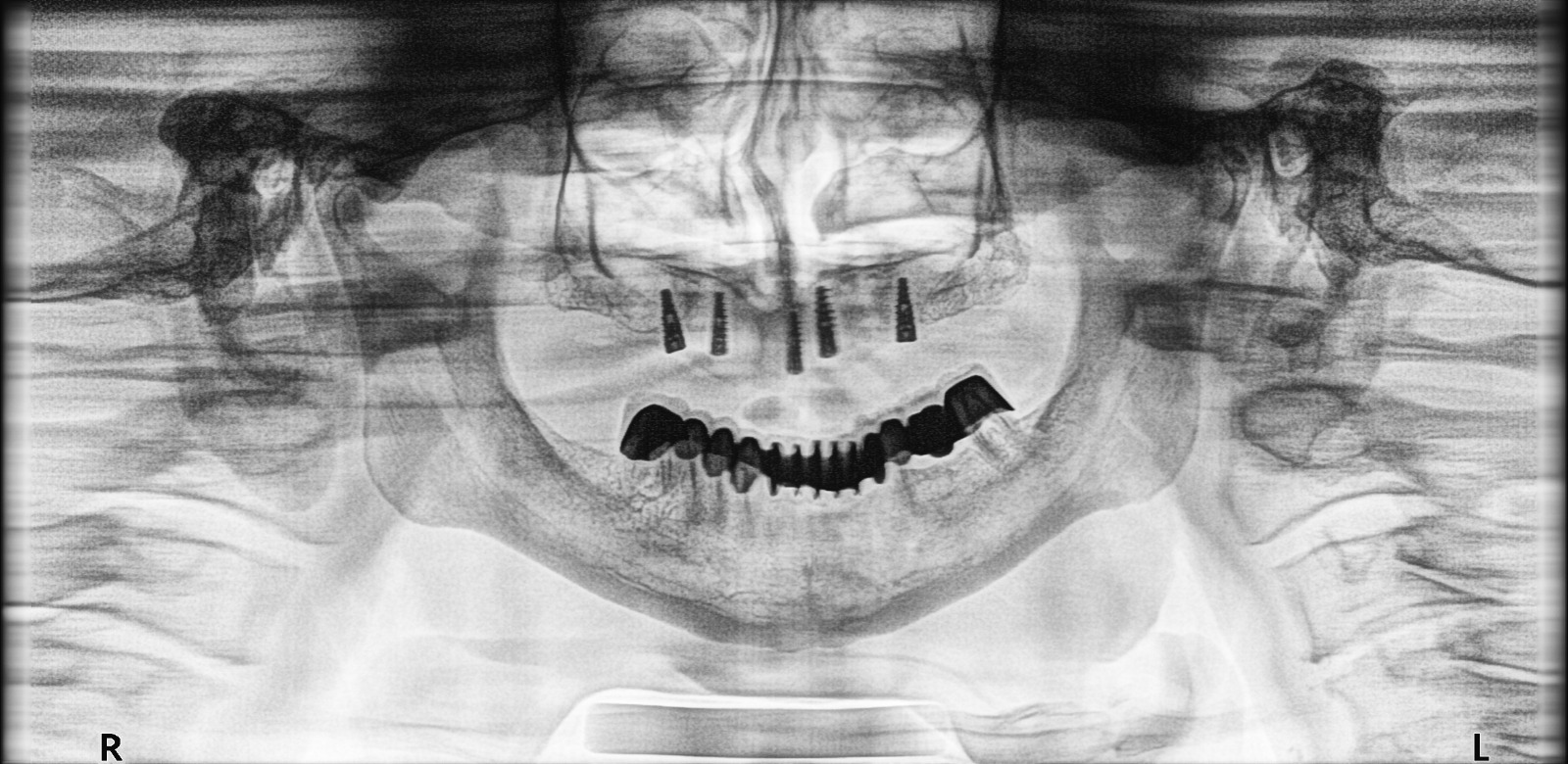 Mehsana dental clinic & implant center photo 35