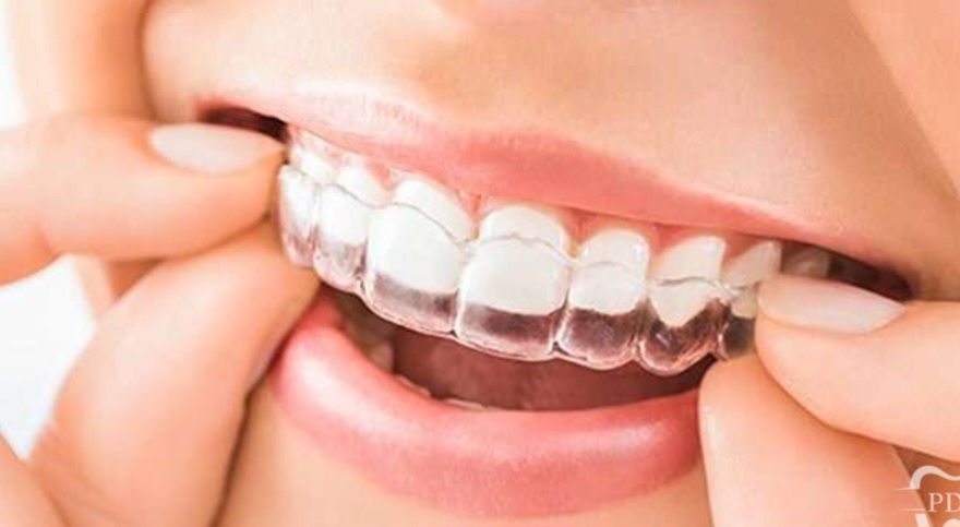 Mehsana dental clinic & implant center photo 18