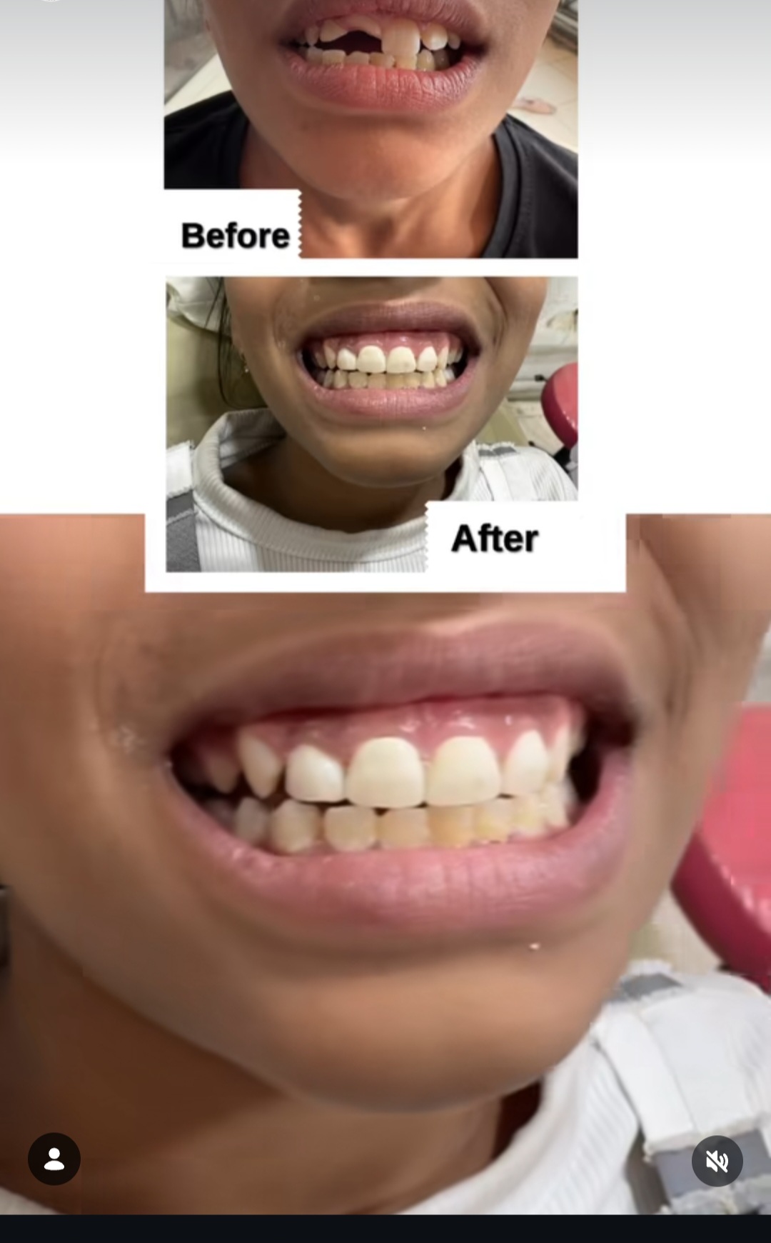 Mehsana dental clinic & implant center photo 13