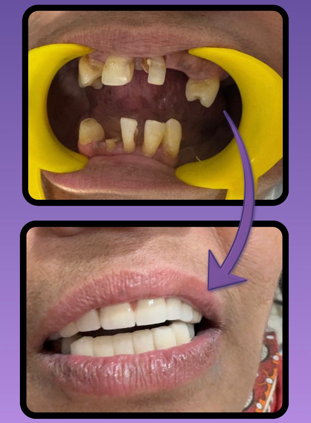 Mehsana dental clinic & implant center photo 39