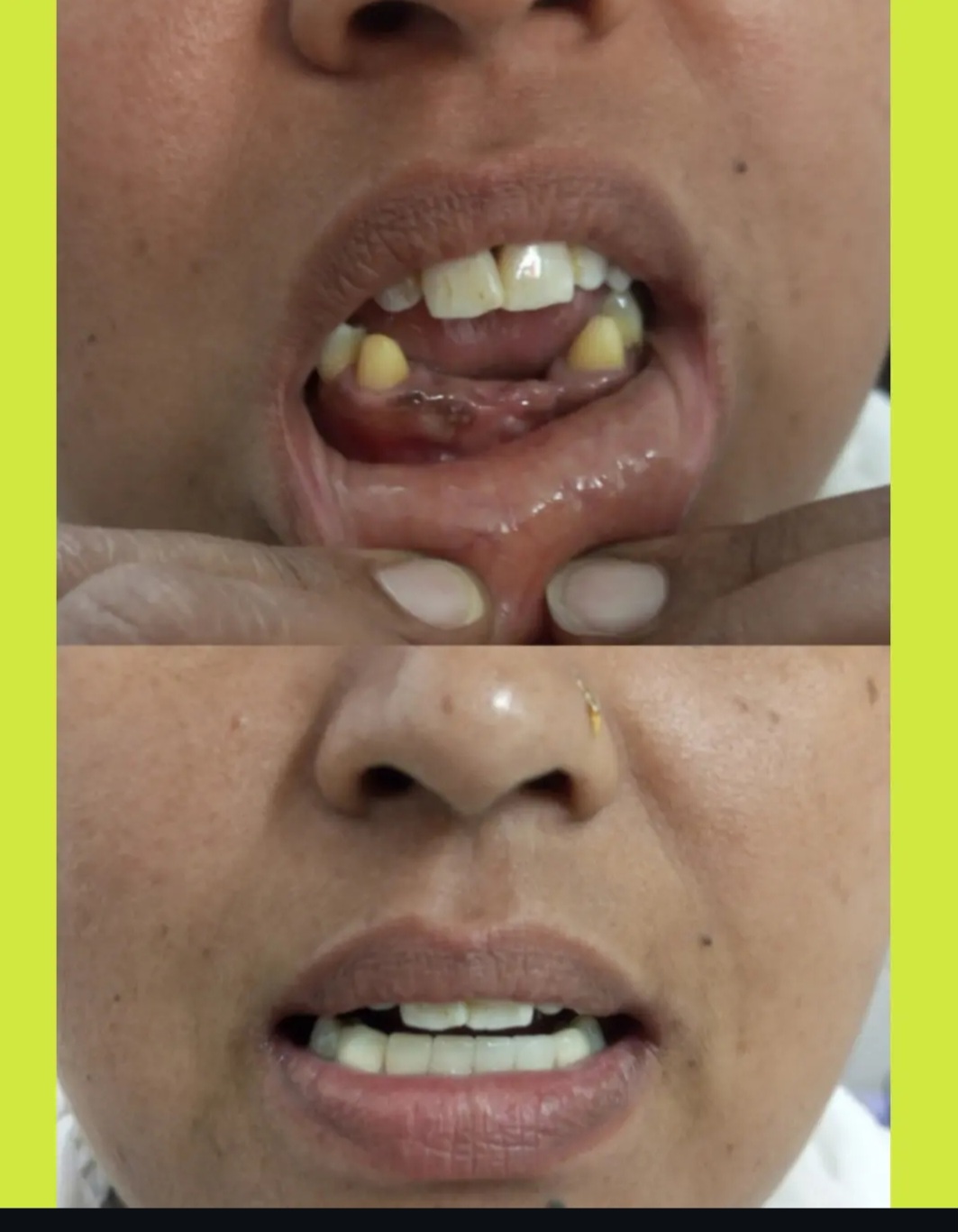 Mehsana dental clinic & implant center photo 16