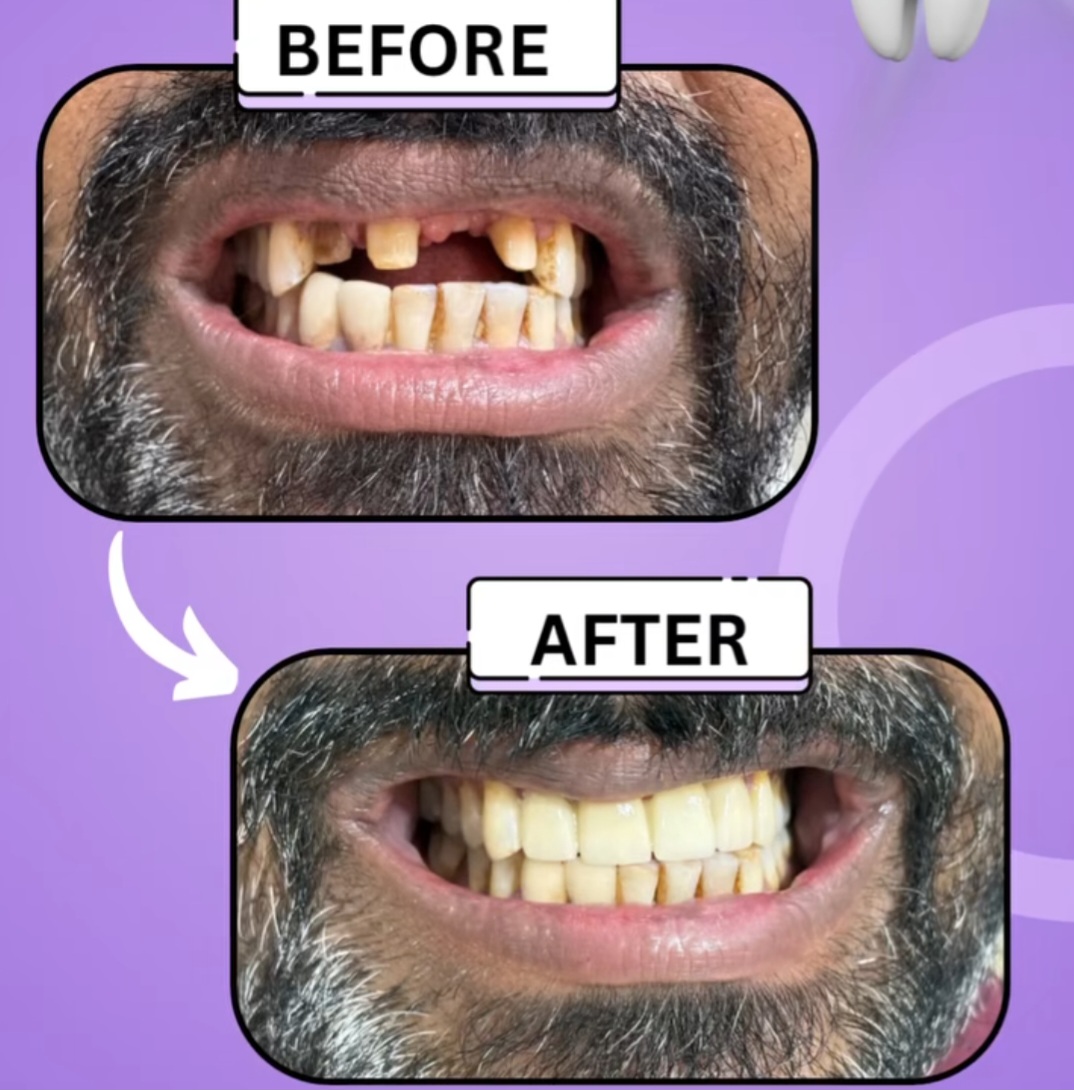 Mehsana dental clinic & implant center photo 40