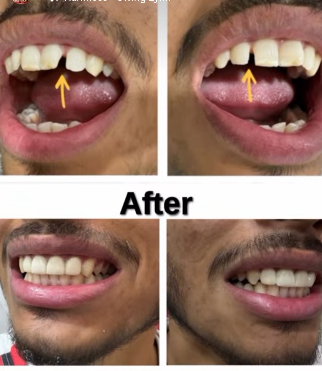 Mehsana dental clinic & implant center photo 30