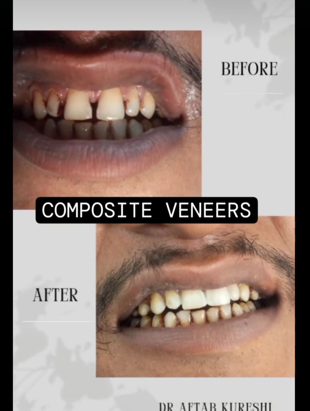 Mehsana dental clinic & implant center photo 20