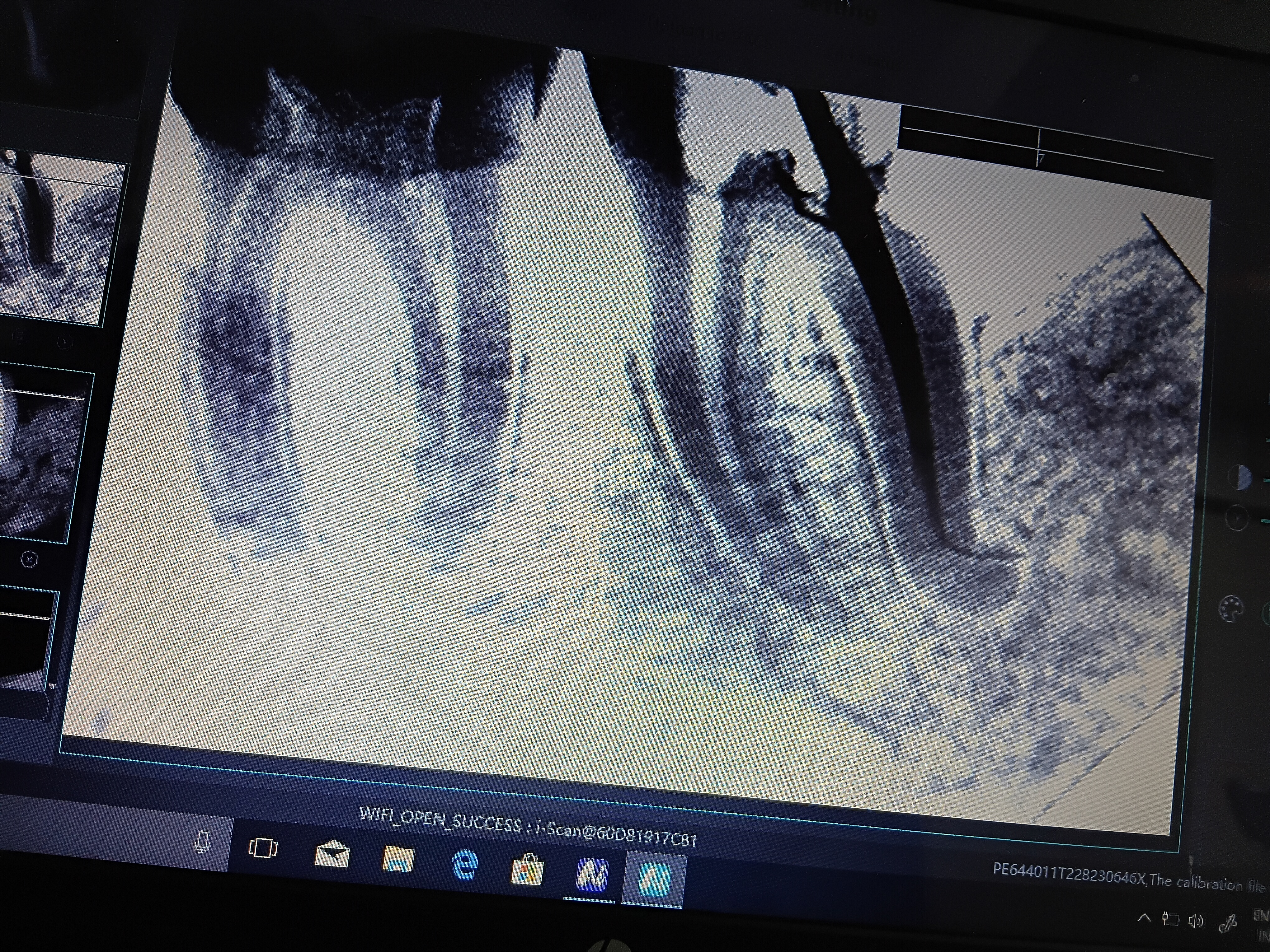 Mehsana dental clinic & implant center photo 29