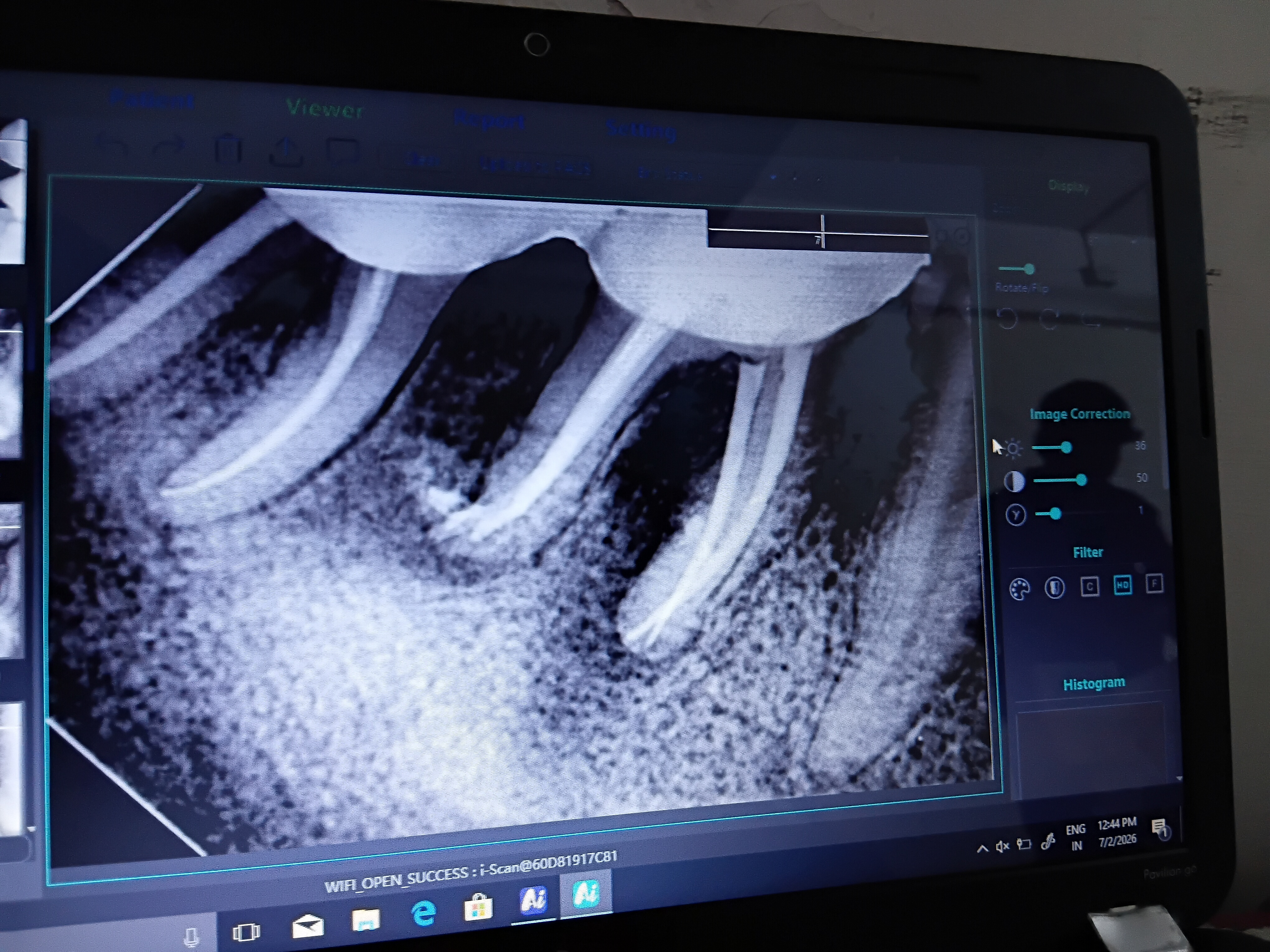 Mehsana dental clinic & implant center photo 34