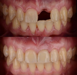 Mehsana dental clinic & implant center photo 36