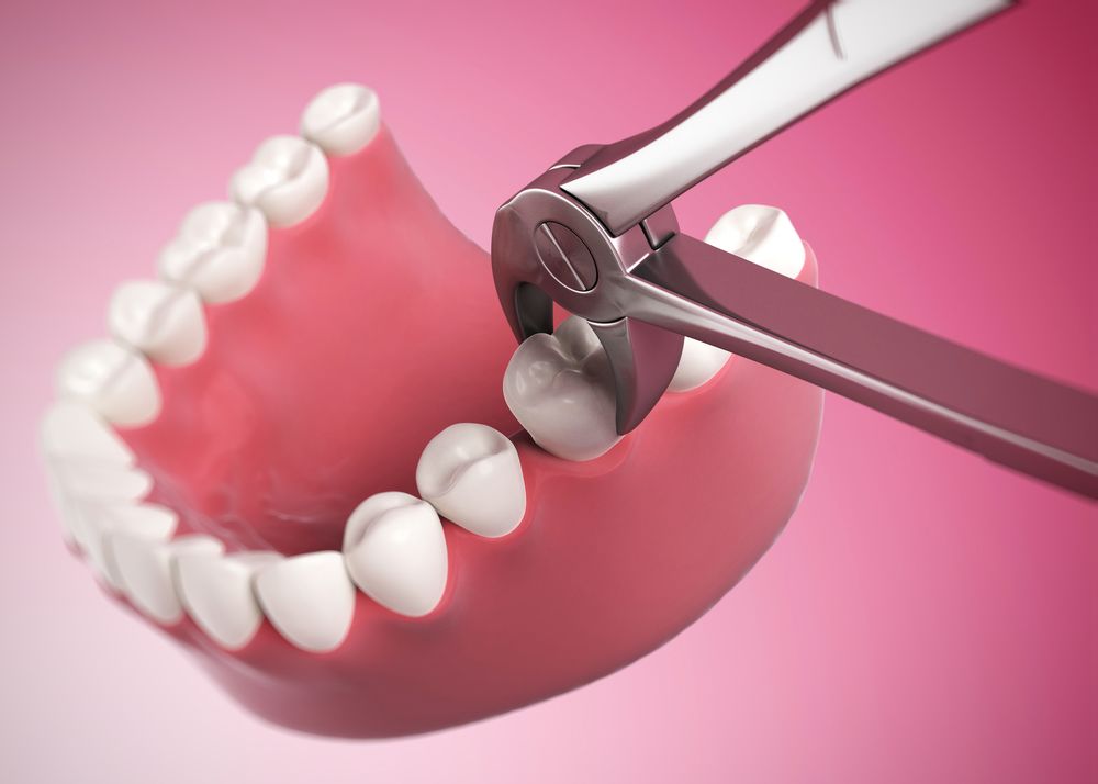 Sunrise Dental Yakima