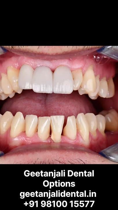 GEETANJALI DENTAL OPTIONS Dental clinic south Delhi Dentist near me