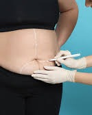 Low Cost Obesity Surgery in Goa photo 3