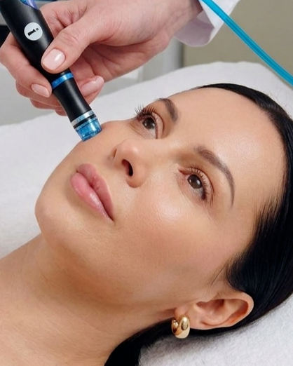 Evolve skinbar photo 1