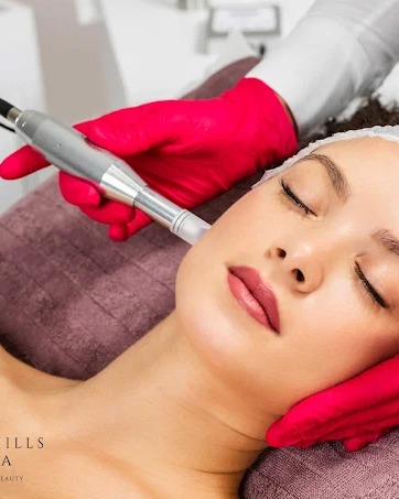 Beverly Hills Med Spa photo 2